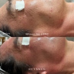 에스테틱 헤이스너그
