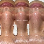 에스테틱 헤이스너그
