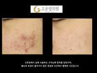 고운빛의원