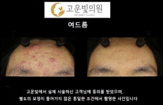 고운빛의원