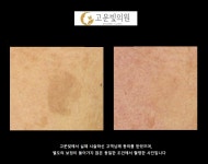고운빛의원