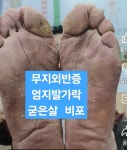 뷔크두피탈모센터 수원점
