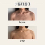 바름바디케어