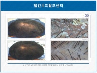 웰킨두피탈모센터 청량리점