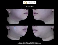 고운빛의원