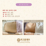 허그맘케어