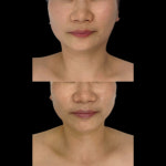 더예뻐지다 전주에코시티점