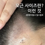 밀스칼프SMP 대구본점