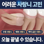 서울유플란트치과의원 청량리