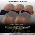 밀스칼프SMP 대구본점