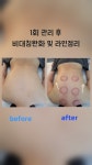에블바디 문제성피부 의정부민락점