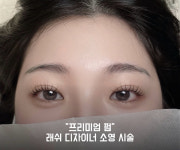 빛나