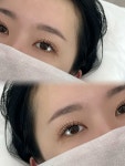 올킬