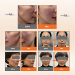 강남아이디의원