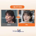 강남아이디의원