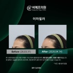 비에프의원