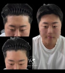 두잉