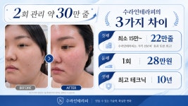 수라인테라피