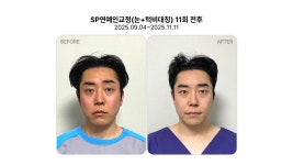 리샘한의원 압구정점