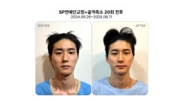 리샘한의원 압구정점