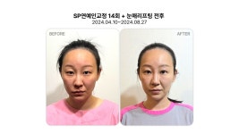 리샘한의원 압구정점