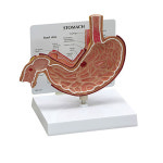 (GPI 인체모형) 위궤양 모형(G200) : 성진메드