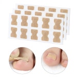 셀프 내성발톱 반창고 보호밴드밴드  패치 내성발톱교정 테이프 스티커 밴드 테이핑 10p : 맘마콩