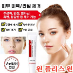 반점 제거 연고 주근깨반점멜라닌흑반황갈반 등 모두 제거 가능 : 보스우