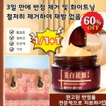 [바르면 밝아짐] 화이트닝 및 반점 제거 크림 : Monoreap