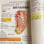 침술 뜸 노트 학술 경험 건강 도서 1. 1 book : 오더박스49호점