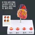 동물병원 개 심장 모형 신장 교육용 연구 해부학 교구용 확대 : 글로피아