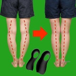 휜다리깔창 교정보호자세 팔자걸음 안짱다리 오다리 골반 평발 패드 발편한 운동화 깍창 아치 : 미미샵P