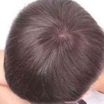 뚜기쩡이 O형 탈모 커버 가발 정수리가발 : 뚜기쩡이