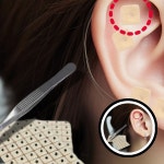 이혈 패치 귀지압 이혈테라피 귀침 혈자리 건강 패치 마사지 통증완화 대체요법 자극치료 : 따라라트레이드