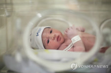 "제왕절개가 인류진화에 영향…난산 증가 추세"