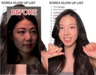 미스미스터미용타운 | "시술 받으려 미국서 한국행"…미용도시 된 서울