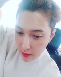 전정아헤어라인 | 김기수가 공개한 헤어라인 수술 후기 "자연스러워"