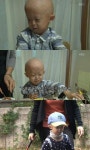 '인간극장' 소아조로증 원기, 돌 무렵 검푸르게 변한 피부에 머리카락이…'눈물'