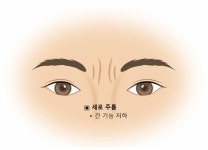 얼굴만 봐도 건강이 보여요 12-미간
