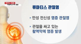 류마티스 관절염 환자, 증상 악화 없이 독감백신 반응 개선 연구 결과 공개…'백신 효과 15~20% 높아져'