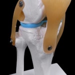 인체모형 뼈 구조대 모형 해부 모델 c90c human anatomical knee aid : 레아누벨르