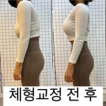 체형교정 필라테스 원데이 체험 확실한 비포애프터 대표원장 직강 : Healthy Barre