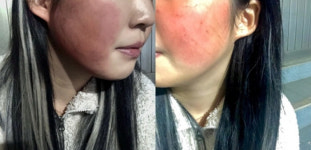 "피가 거꾸로 솟았을 것"…제주 여고생 집단 보복폭행에 판사도 분노