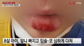 "지인 7살 아들 멱살 잡고 내동댕이"···전직 유명 카레이서, 폭행 혐의 피소