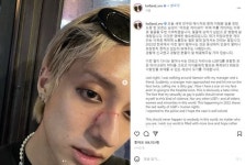 가수 홀랜드 "게이 이유로 폭행…