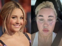 “몰라보게 변했다” 할리우드 배우 아만다 바인즈, 어떻게 바뀌었나 보니?