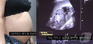 산부인과 교수 "36주 아기 낙태는 살인…낳고 가만 놔둬도 사는데"