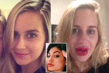 여배우 입술 닮고 싶어서 립 인핸서 사용 ‘대참사’