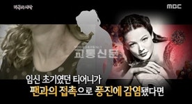 일본 풍진 무서움 일깨워 준 헐리우드 배우