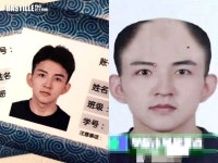 "예능 방송서 머리숱 멀쩡한 제 사진을 도용해